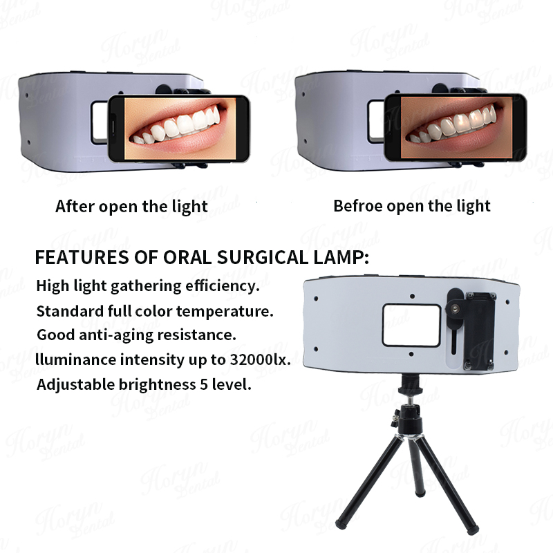 Dental Flash Light Photography - Photography Lighting With Flash review and price